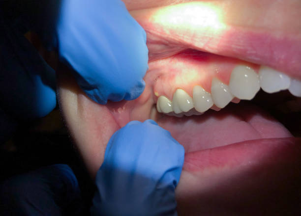 Best Mobile Emergency Dentist in Brunswick, NC